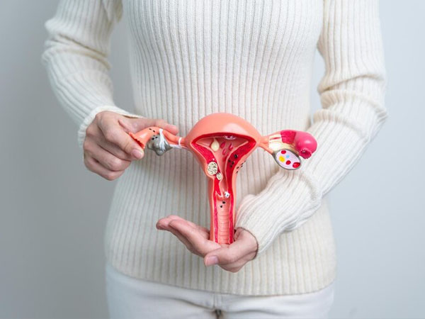 Ovarian Cysts & Tumor Treatment Meerut