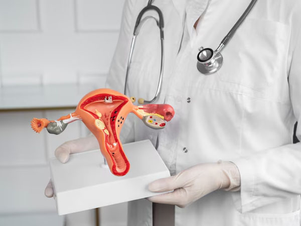 Gynae Cancer Treatment Meerut